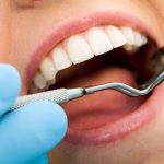 Commonly Overlooked Symptoms of Tooth Decay Kennesaw, GA