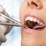 What is Your Tongue Telling You? Kennesaw, GA